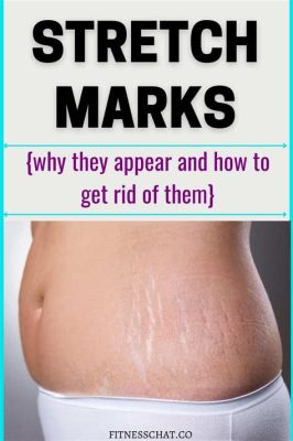 How to Make Stretch Marks Stop Itching: Exploring the Connection Between Skin Care and Cosmic Energy