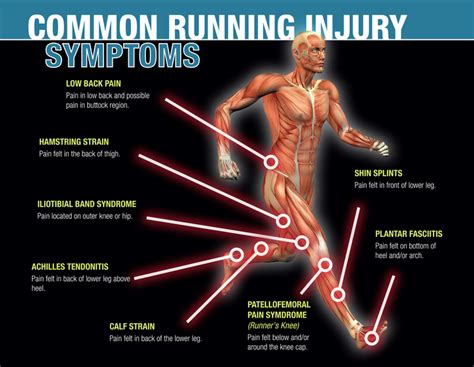 Lower Legs Hurt When Running: Exploring the Paradox of Pain and Pleasure in Endurance Sports